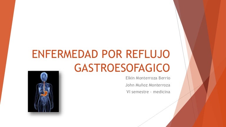 Recomendaciones para enfermedad por reflujo gastroesofagico
